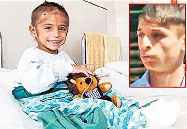 In 2002, Romania's "Mowgli Boy" was reunited with his mother, Lina Caldarar, after years of living with wild animals in the forests of Transylvania. 

Traian — nicknamed Mowgli by hospital staff after the character in The Jungle Book — was found by a shepherd, barely alive, huddled in a cardboard box, naked and the size of a three-year-old. He had forgotten how to speak. Doctors say it would have been almost impossible for him to have survived alone, and believe he was looked after by wild dogs in the Transylvanian forests.

His mother, who recognized him from a television news report, said that she had fled from her husband's home three years earlier after he beat her. She believes Traian ran away for the same reason.