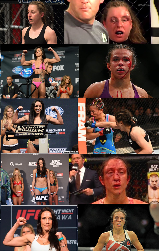 Joanna Jedrzejczyk’s victims: before and after