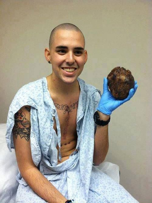 A man holding his old heart following a succesful heart transplant surgery