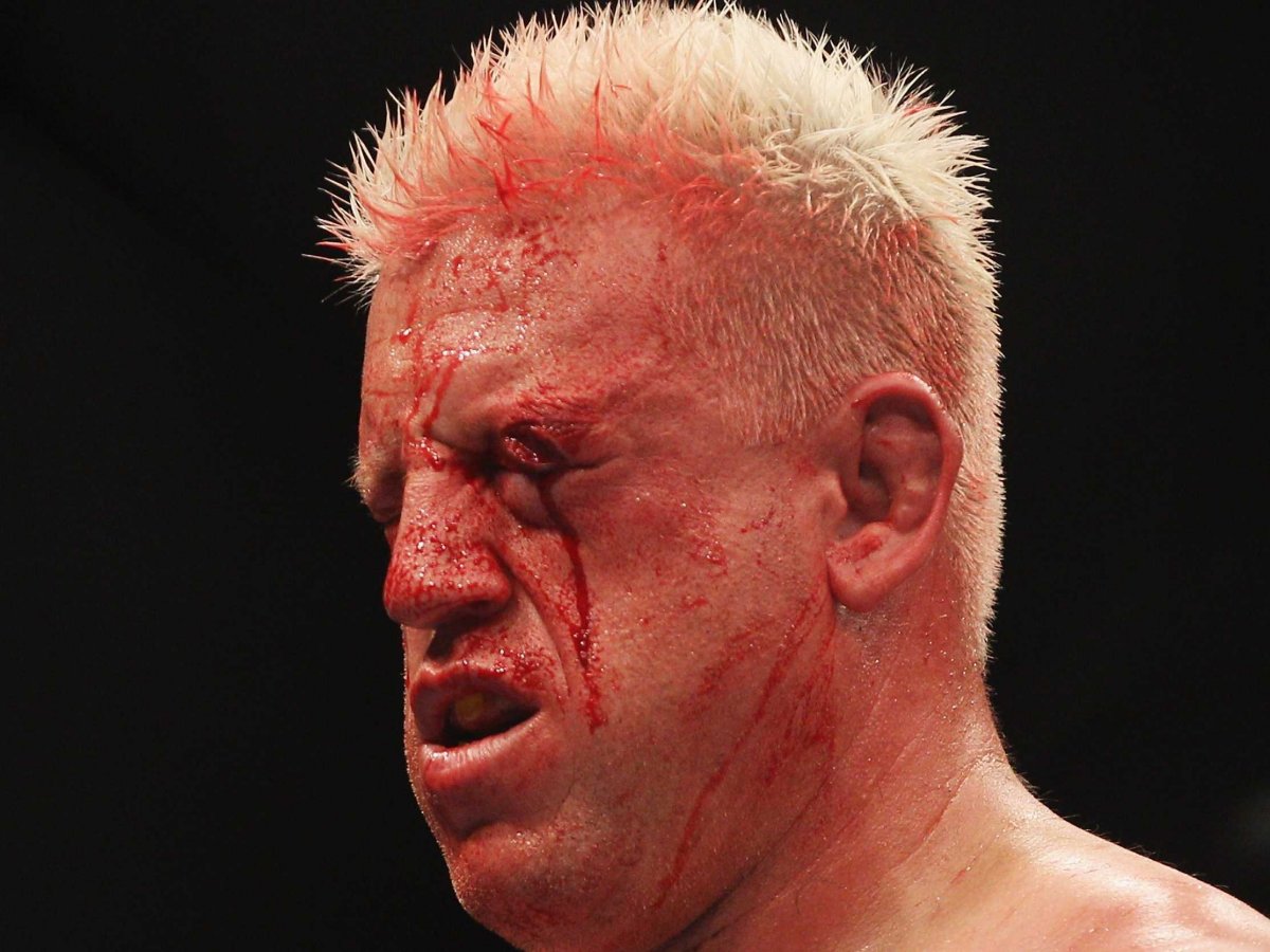 The Most Horrific Post-Fight Faces Ever