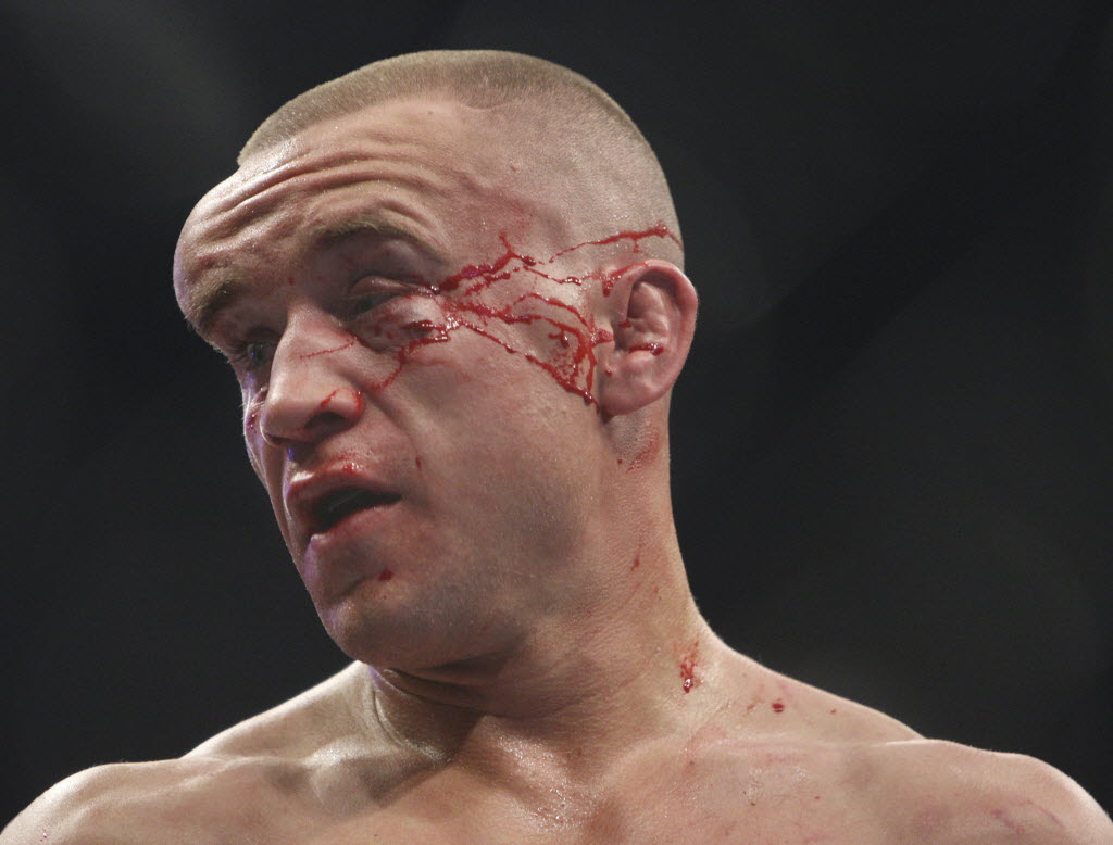 The Most Horrific Post-Fight Faces Ever