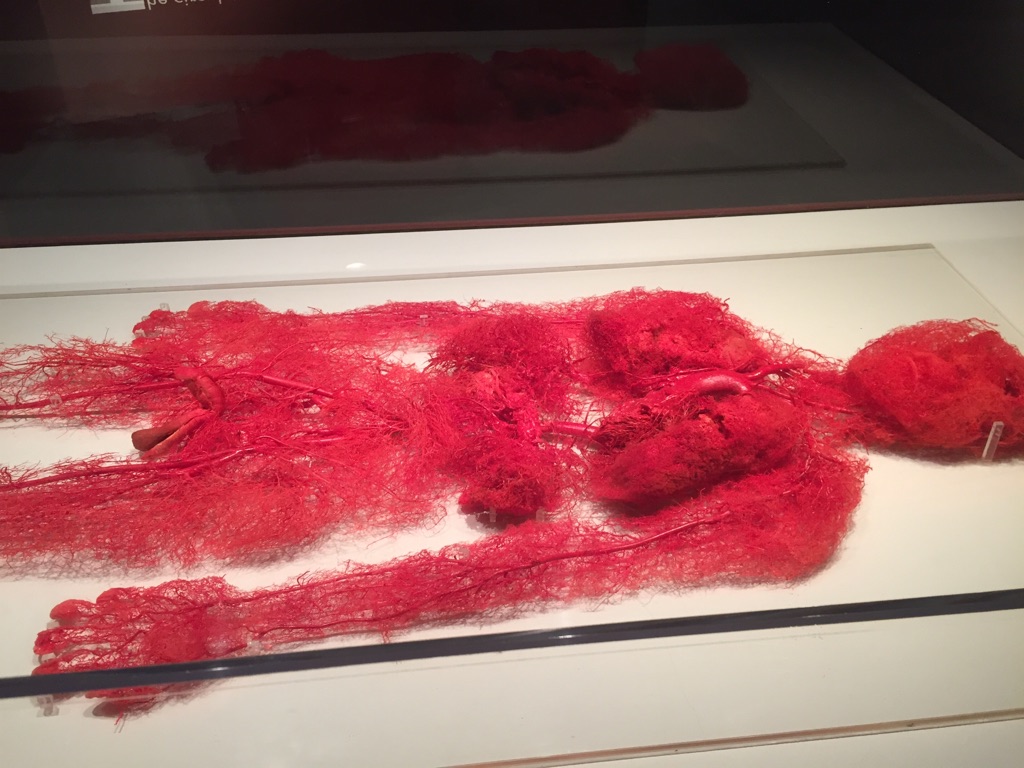 This is the blood vessels of a real person who donated there body for scientific display purposes