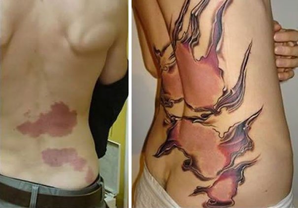 30 Unwanted birthmarks covered up with brilliant tattoos