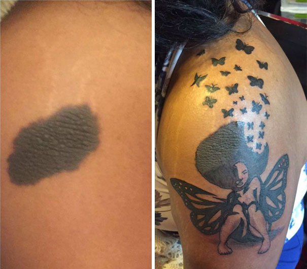 30 Unwanted birthmarks covered up with brilliant tattoos