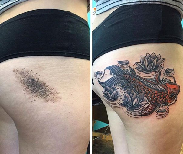 30 Unwanted birthmarks covered up with brilliant tattoos