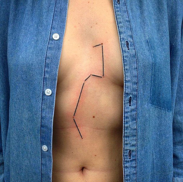 30 Unwanted birthmarks covered up with brilliant tattoos