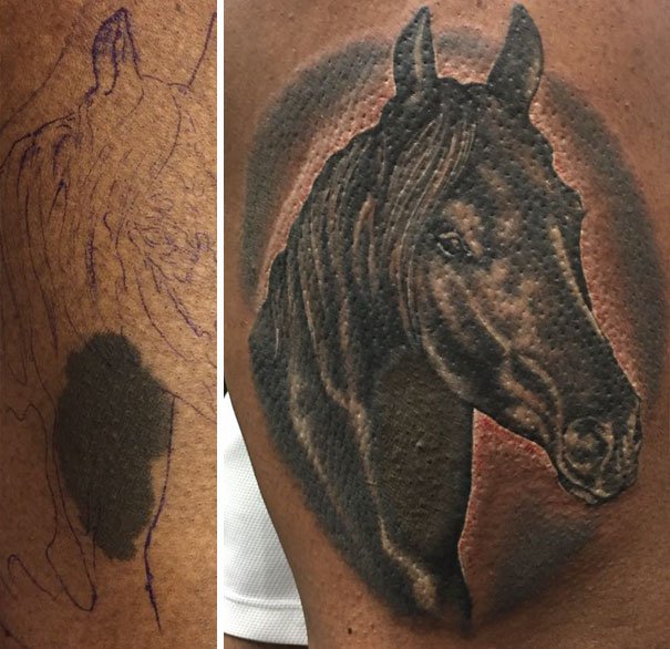 30 Unwanted birthmarks covered up with brilliant tattoos