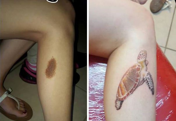 30 Unwanted birthmarks covered up with brilliant tattoos