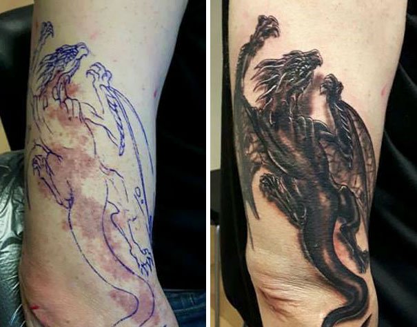 30 Unwanted birthmarks covered up with brilliant tattoos