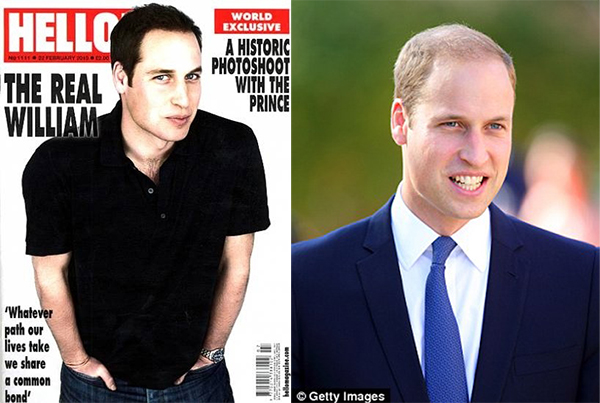 In 2010, already balding British royal, Prince William, then 27, appeared on the cover of Hello! magazine with a suspicious head of full, dark hair, looking very much like a member of Fall Out Boy. While it looks as though the prince dyed his locks, images from around the same time prove the cover photo was likely the result of some overzealous Photoshopping.