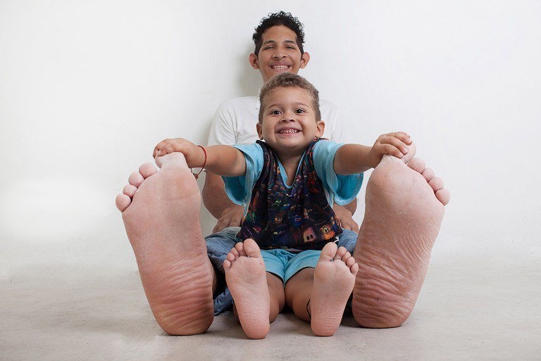 Who has the biggest feet in the world?
Jeison Orlando Rodriguez Hernandez, 20, of Venezuela, is the owner of the largest feet in the world of a living human being. He wears a size 26 shoe.