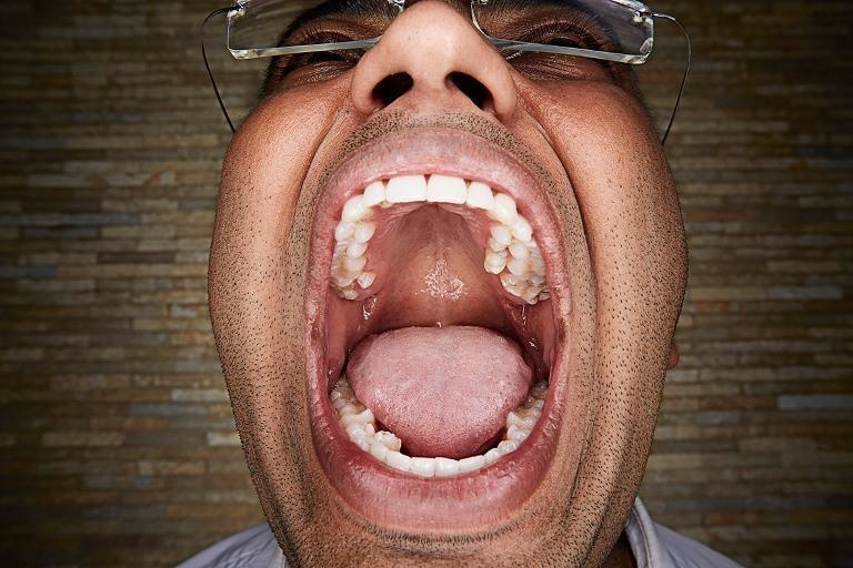 This guy has the most teeth in a mouth
Vijay Kumar, who lives in Bangalore, India, has 37 teeth in his mouth. That's five more than the average human mouth. It's probably an added expenses for his dental insurance!
