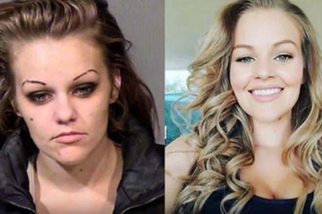 Girl before versus after four years without heroin and amphetamine