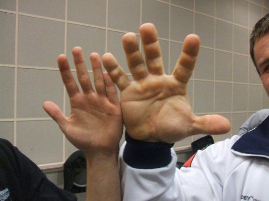 Ukrainian Arm Wrestler Denis Cyplenkov’s Hands Are So Big They Look Fake