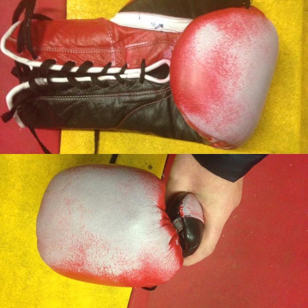 These grant gloves were used in a world title fight in 2016. The gloves were smeared with Acetate which is an acid fluid that burns the eyes and effects breathing. Imagine cheating like this just to win a fight.

My fighter was the victim of this cheating and he complained that his eyes were burning all through the fight. When we brought him to the hospital after the fight he couldn’t see and was having trouble breathing – @nowhere2hyde