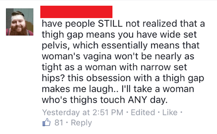 wide set vag - have people Still not realized that a thigh gap means you have wide set pelvis, which essentially means that woman's vagina won't be nearly as tight as a woman with narrow set hips? this obsession with a thigh gap makes me laugh.. I'll take