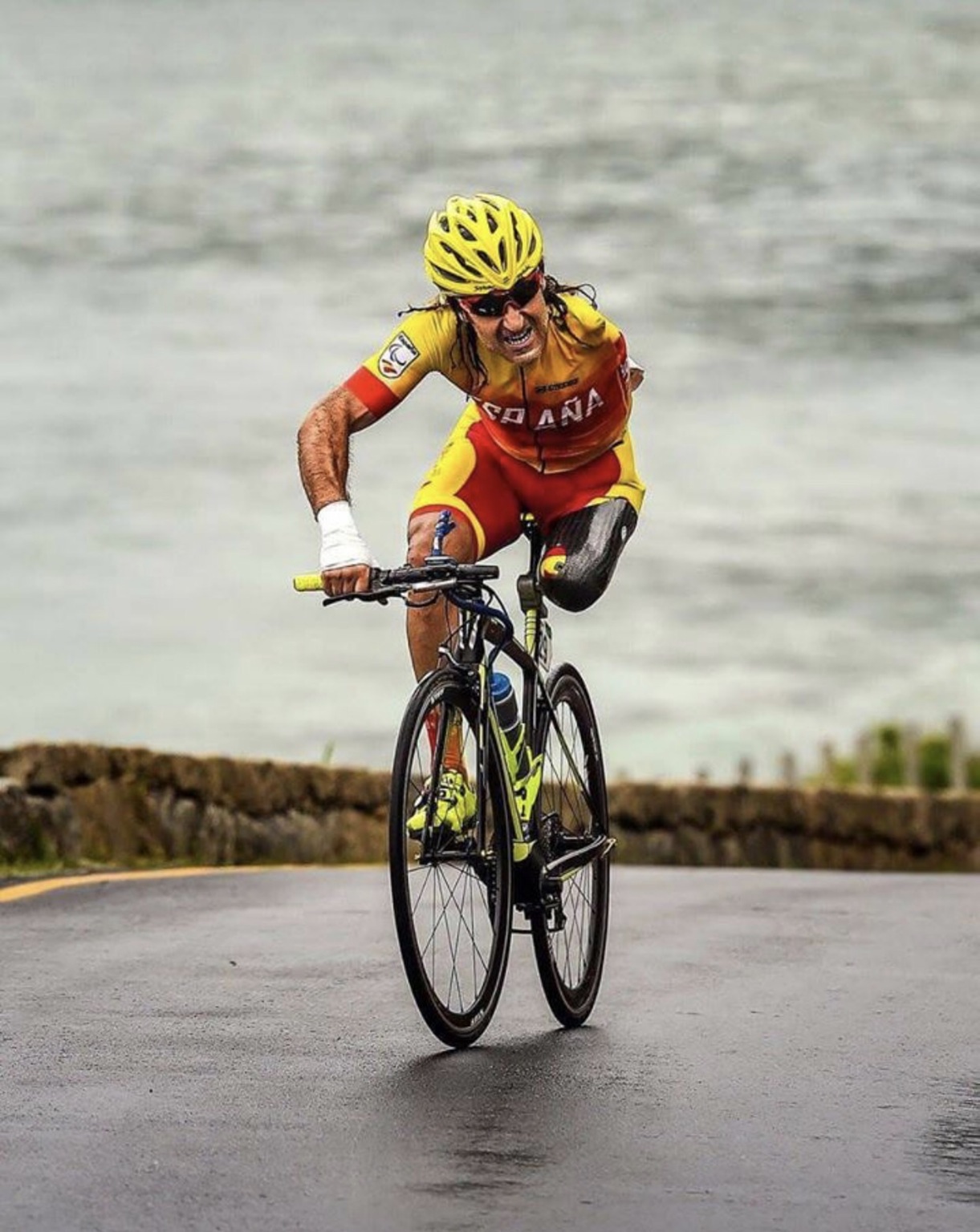 Juan Jose Mendez- was in a car accident and considered dead on site. They massaged his heart for more than a half an hour and he received 48 Liters of blood. He has been in the Elite of Paralympic cycling for 20 years now.