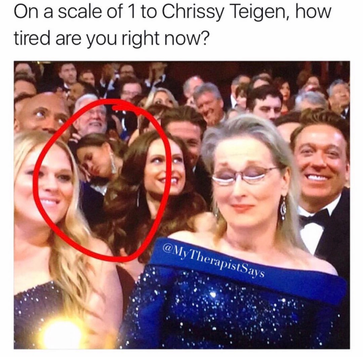 chrissy teigen meme - On a scale of 1 to Chrissy Teigen, how tired are you right now? Therapist Says