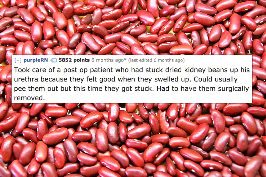 kidney beans - purpleRN 5852 points 6 months ago last edited 6 months ago Took care of a post op patient who had stuck dried kidney beans up his urethra because they felt good when they swelled up. Could usually pee them out but this time they got stuck. 