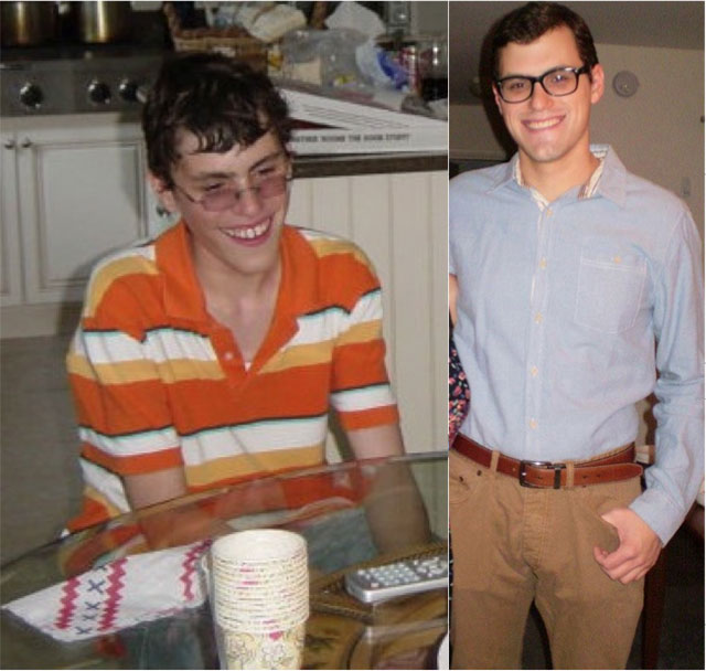 20 People Share Their Incredible ‘Ugly Duckling’ Transformations