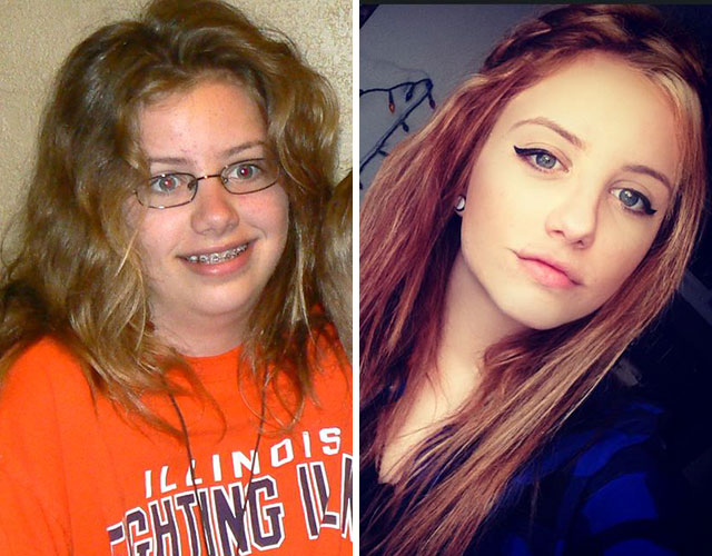 20 People Share Their Incredible ‘Ugly Duckling’ Transformations