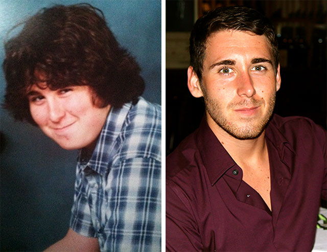 20 People Share Their Incredible ‘Ugly Duckling’ Transformations