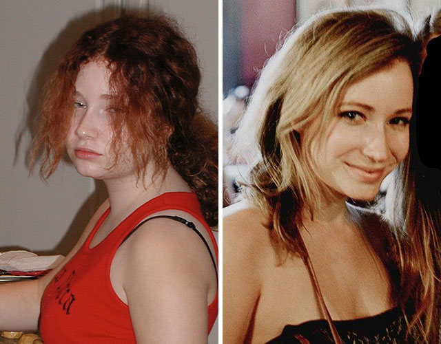 20 People Share Their Incredible ‘Ugly Duckling’ Transformations