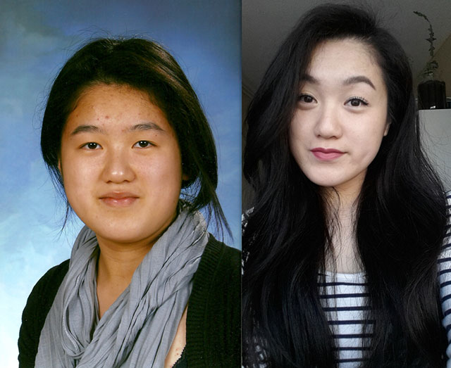 20 People Share Their Incredible ‘Ugly Duckling’ Transformations