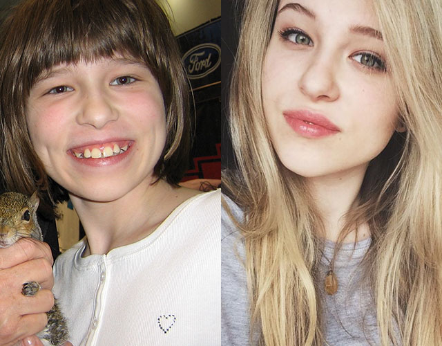 20 People Share Their Incredible ‘Ugly Duckling’ Transformations