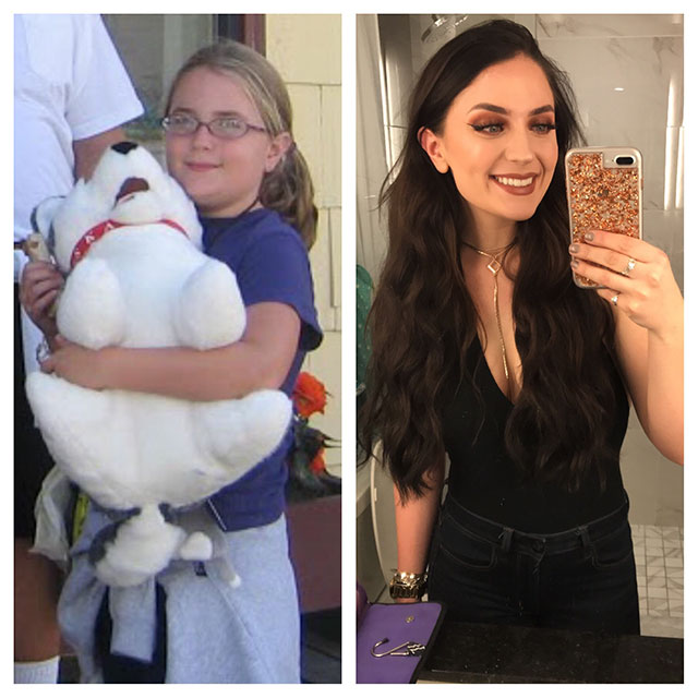 20 People Share Their Incredible ‘Ugly Duckling’ Transformations