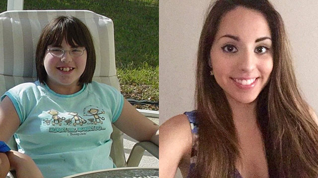 20 People Share Their Incredible ‘Ugly Duckling’ Transformations