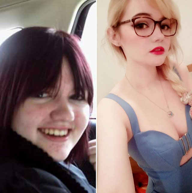 20 People Share Their Incredible ‘Ugly Duckling’ Transformations