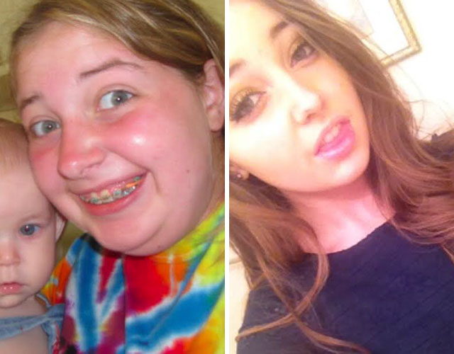 20 People Share Their Incredible ‘Ugly Duckling’ Transformations