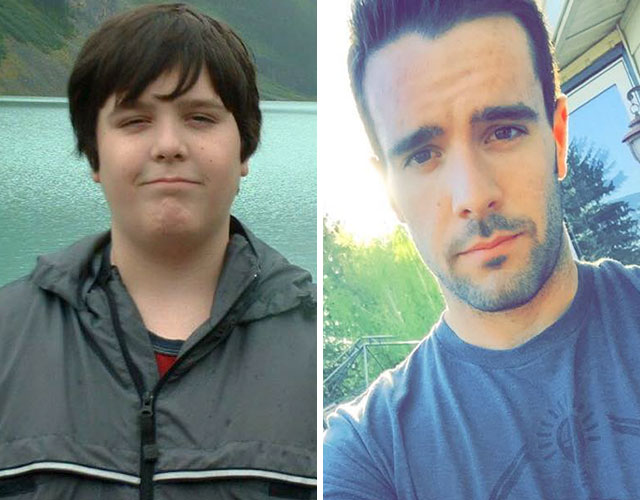 20 People Share Their Incredible ‘Ugly Duckling’ Transformations