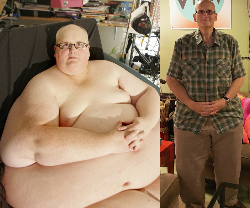 World’s Fattest Man after losing +700 lbs