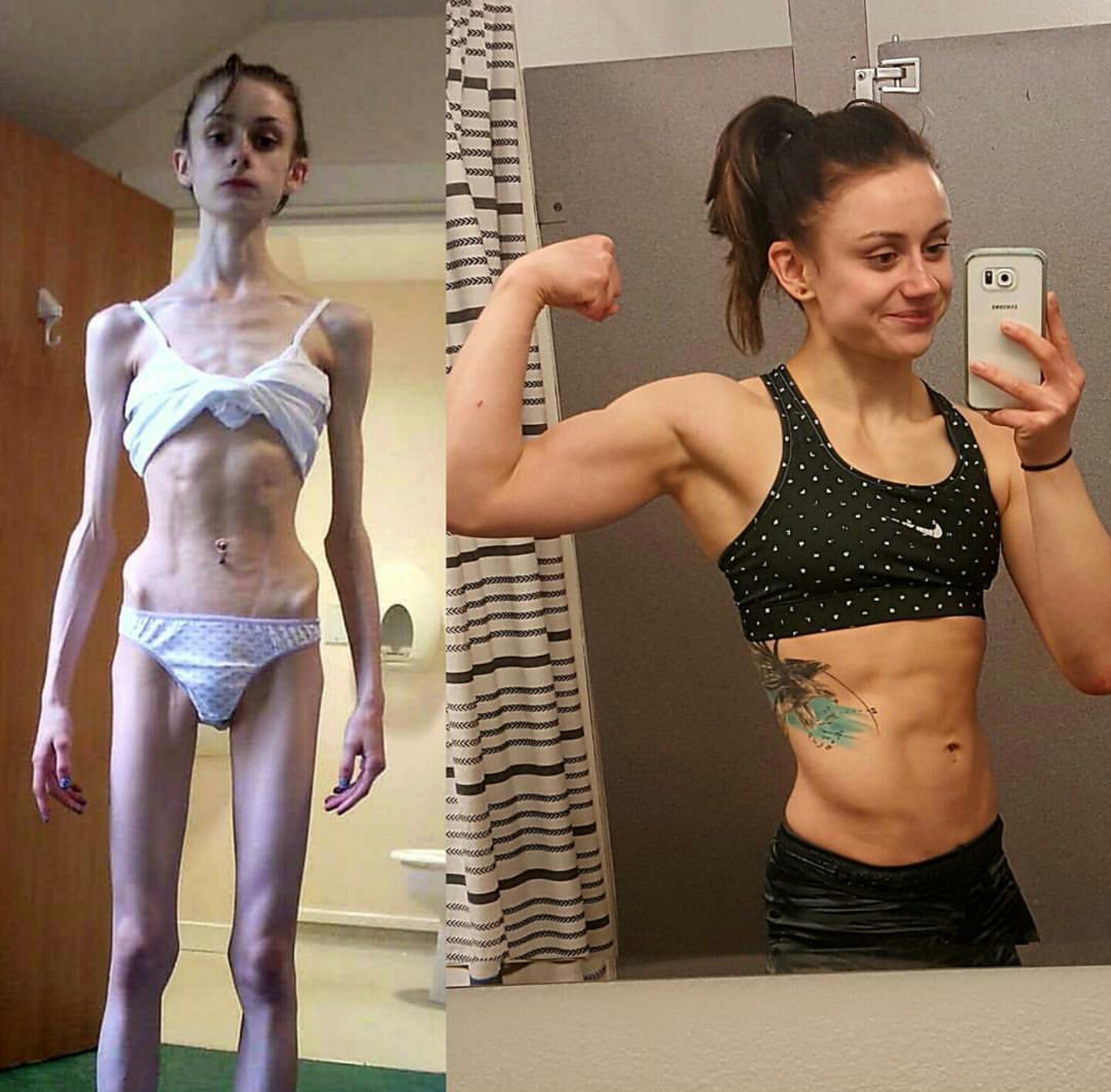 Before and after anorexia