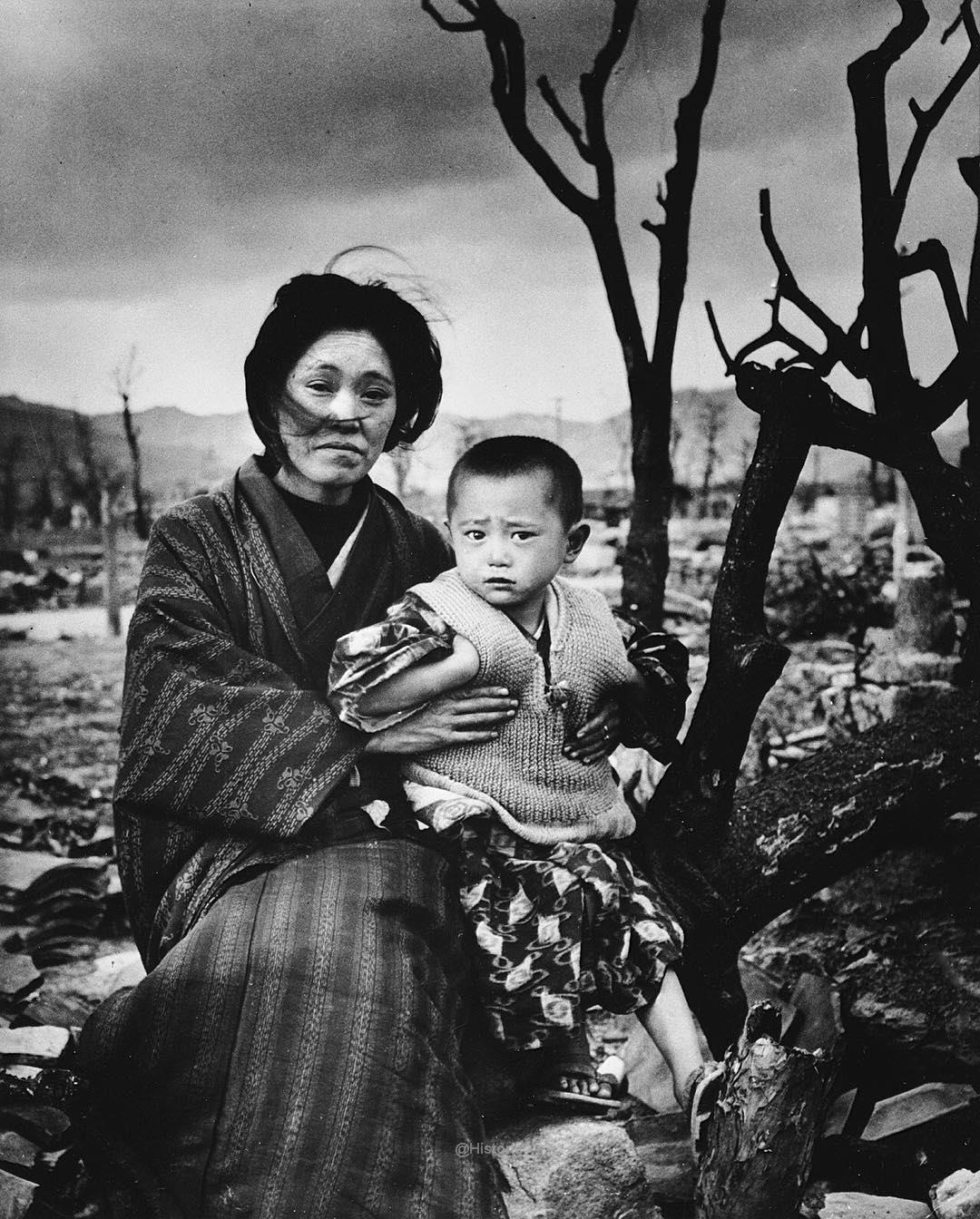 A mother and child in Hiroshima, four months after the atomic bombing. 1945