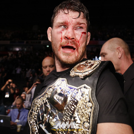 Michael Bisping after the Dan Henderson fight