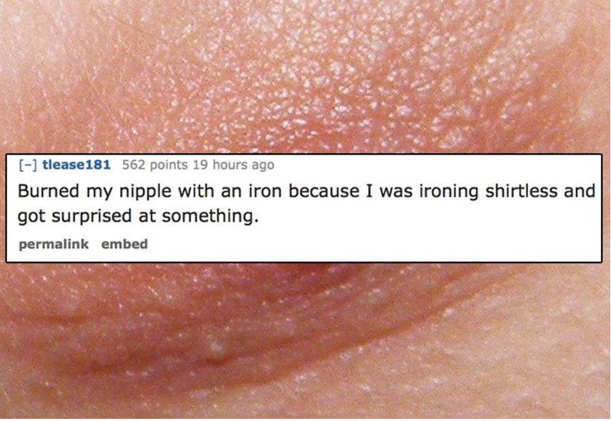 12 People Share The Dumbest Ways They Hurt Themselves