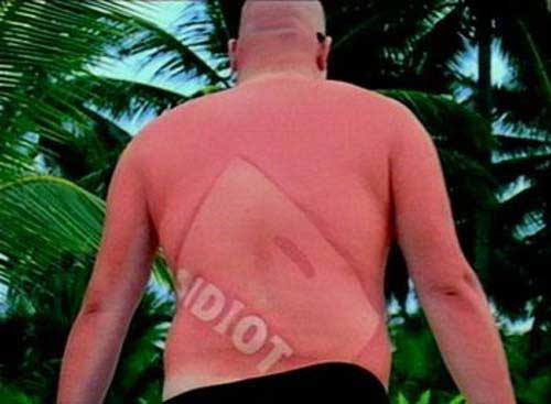 25 epic sunburns