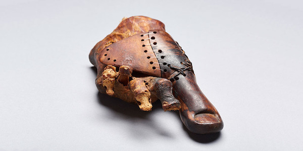 A priest's daughter lost her big toe around 3000 years ago. When she died, she was entombed near Luxor, Egypt in a cemetery reserved for elite members of the community. In 2017, she and her prosthetic toe were found by Swiss scientists from the University of Basel. 

The prosthesis is likely the oldest of its kind. Made of wood, it came with panels that can be laced together to keep it snug, and it had been refitted more than once. “The fact that the prosthesis was made in such a laborious and meticulous manner indicates that the owner valued a natural look, aesthetics, and comfort, and she was able to count on highly qualified specialists to provide this,” said a University of Basel press release.