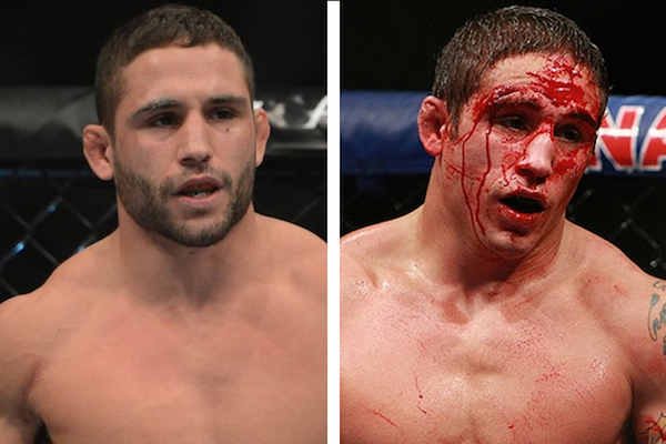 14 of the Most Brutal Before and After Pics of UFC Fighters