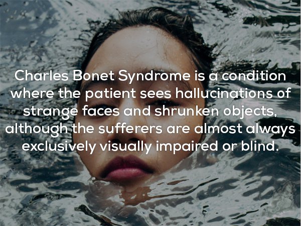 Fun fact about Charles Bonet Syndrome