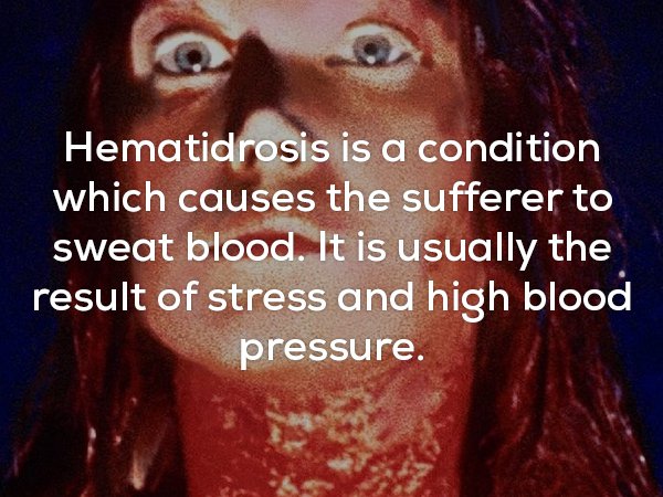 Fun fact about Hematidrosis which is a condition that causes the sufferer to sweat blood.