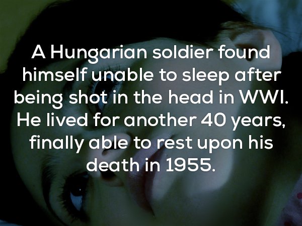 Fact about Hungarian soldier who couldn't sleep after being shot in the head.