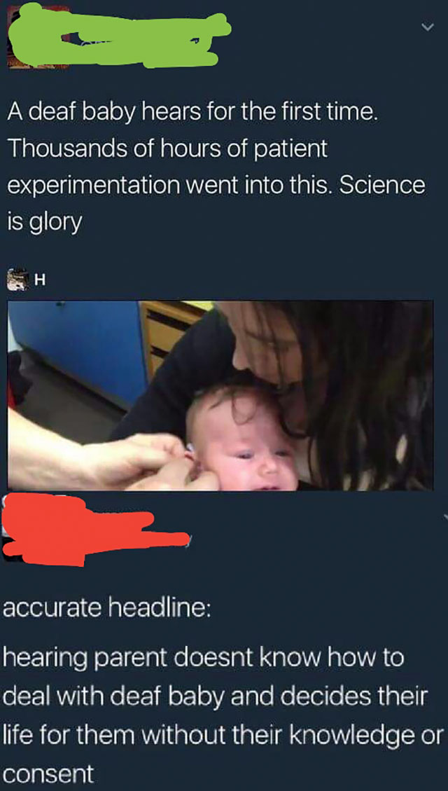 sjw cringw - A deaf baby hears for the first time. Thousands of hours of patient experimentation went into this. Science is glory accurate headline hearing parent doesnt know how to deal with deaf baby and decides their life for them without their knowled