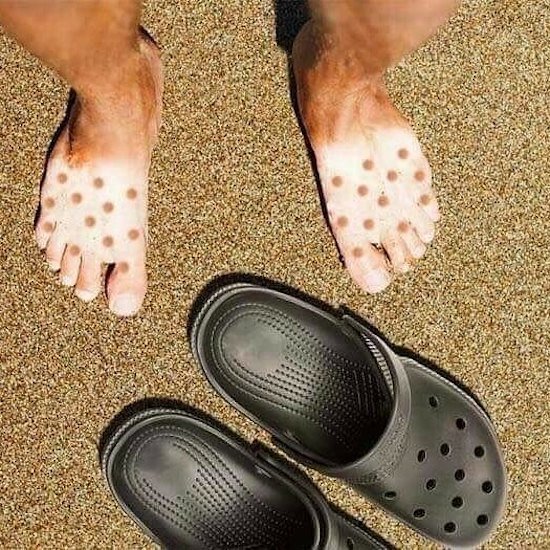 happens when you wear crocs