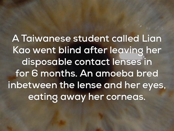 photo caption - A Taiwanese student called Lian Kao went blind after leaving her disposable contact lenses in for 6 months. An amoeba bred inbetween the lense and her eyes, eating away her corneas.