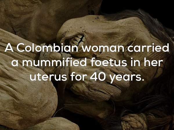 scary facts - A Colombian woman carried a mummified foetus in her uterus for 40 years.