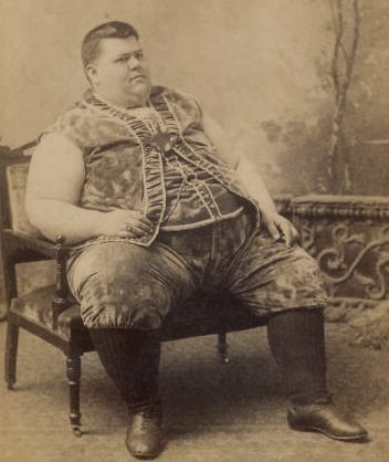 Circus "freak" the fat man, from 100 years ago.